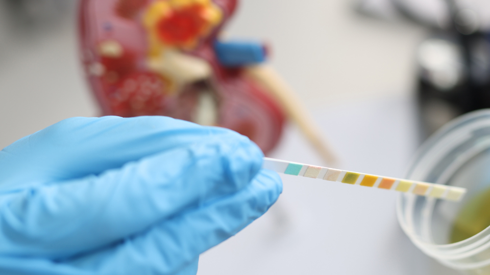 Penile Cancer Treatment in London: Expert Care at Harley Street Andrology